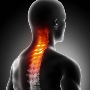 Cervical Spine Disc Degeneration