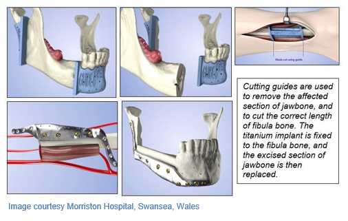 kap blog cutting guide.png