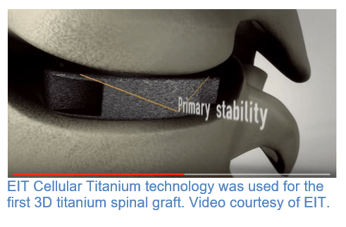 3d printing cellular titanium technology