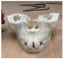 3d-printed-body-parts