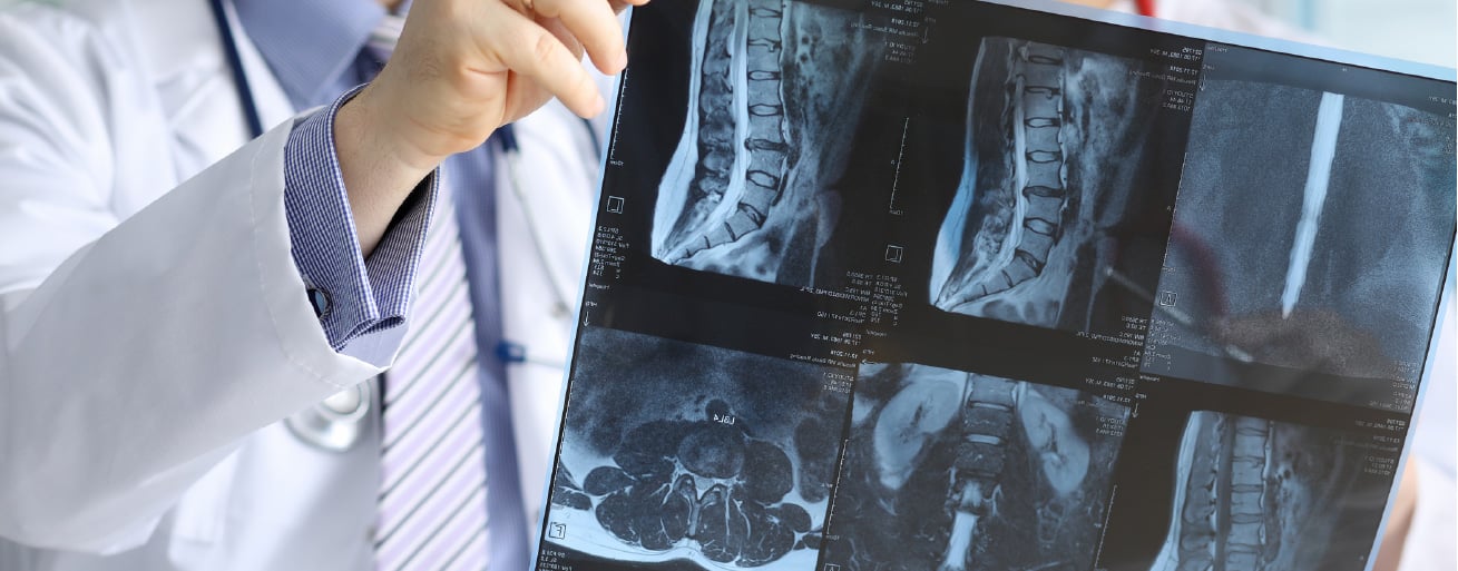 How Kapstone Helps Medical Device Companies Upgrade Their QMS